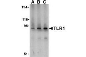 Western blot analysis of TLR1 in mouse spleen lysate with this product at (A) 1, (B) 2, and (C) 4 μg/ml. (TLR1 anticorps  (N-Term))