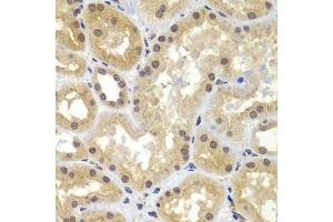 Immunohistochemistry of paraffin-embedded human kidney using CEBPG antibody (ABIN5974381) at dilution of 1/100 (40x lens). (CEBPG anticorps)