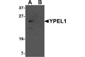Western blot analysis of YPEL1 in Hela cell lysate with YPEL1 antibody at 1 ug/mL in (A) the absence and (B) the presence of blocking peptide. (YPEL1 anticorps  (N-Term))