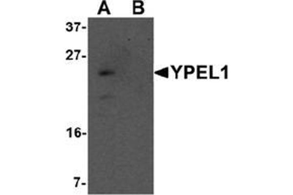 YPEL1 antibody  (N-Term)