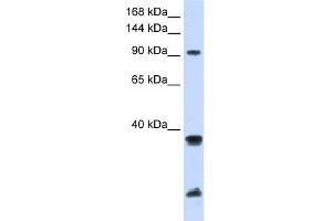 WB Suggested Anti-RNF20 Antibody Titration:  0. (RNF20 anticorps  (Middle Region))