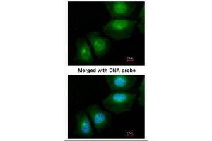 ICC/IF Image Immunofluorescence analysis of paraformaldehyde-fixed HeLa, using S100A11, antibody at 1:200 dilution.