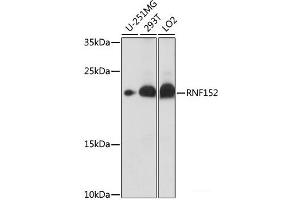 Western blot analysis of extracts of various cell lines using RNF152 Polyclonal Antibody at dilution of 1:1000. (RNF152 anticorps)