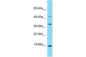 Host: Rabbit Target Name: C17orf89 Sample Type: Fetal Lung lysates Antibody Dilution: 1. (C17ORF89 anticorps  (N-Term))