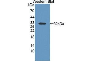 Western blot analysis of the recombinant protein. (PVRL4 anticorps  (AA 31-317))