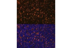 Immunofluorescence analysis of rat spleen using CCR7 Rabbit mAb (ABIN7266309) at dilution of 1:100 (40x lens).