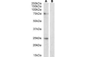 ABIN361190 (2µg/ml) staining of Rat Pancreas lysate (A) + Peptide (B) (35µg protein in RIPA buffer).