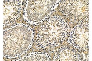ABIN6260383 and ABIN6279247 at 1/100 staining rat testis tissue by IHC-P.