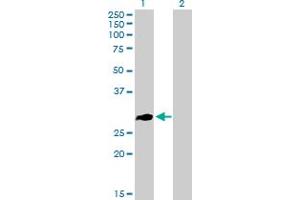 Western Blot analysis of ZNF32 expression in transfected 293T cell line by ZNF32 MaxPab polyclonal antibody. (ZNF32 anticorps  (AA 1-273))