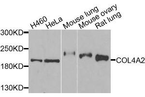 Western blot analysis of extracts of various cells, using COL4A2 antibody. (COL4a2 anticorps)