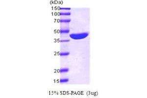 Figure annotation denotes ug of protein loaded and % gel used. (Maltose Binding Protein Protein (MBP) (AA 1-387))