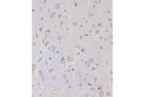 Immunohistochemistry of paraffin-embedded Mouse brain using OR2S2 Rabbit pAb (ABIN7269087) at dilution of 1:100 (40x lens).