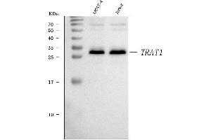 Western blot analysis of TRAT1 using anti-TRAT1 antibody (ABIN7600889).