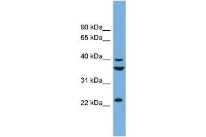 WB Suggested Anti-SAE1  Antibody Titration: 0. (SAE1 anticorps  (N-Term))
