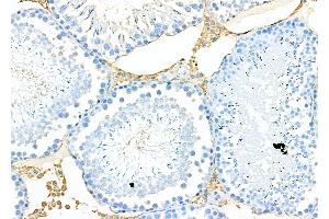 ABIN6262382 and ABIN6276902 at 1/100 staining Rat testis tissue by IHC-P.