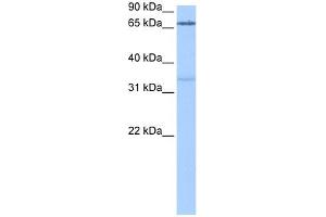 PADI2 antibody used at 0.