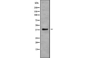Western blot analysis of CCR10 using COLO205 whole cell lysates (CCR10 anticorps  (C-Term))