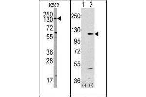 Image no. 1 for anti-Phosphoinositide-3-Kinase, Catalytic, alpha Polypeptide (PIK3CA) (Middle Region) antibody (ABIN360445) (PIK3CA anticorps  (Middle Region))