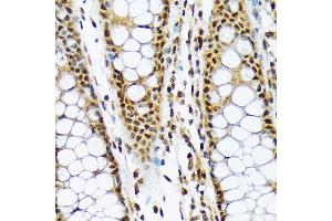 Immunohistochemistry of paraffin-embedded human colon using ML1BP Rabbit mAb (ABIN7268357) at dilution of 1:100 (40x lens).