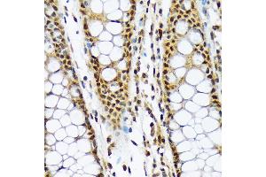 Immunohistochemistry of paraffin-embedded human colon using ML1BP Rabbit mAb (ABIN7268357) at dilution of 1:100 (40x lens). (MAD2L1BP anticorps)