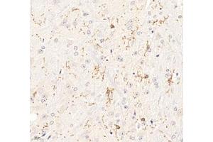Immunohistochemistry of paraffin embedded mouse brain using P2Y12 (ABIN7075321) at dilution of 1: 1400 (400x lens)