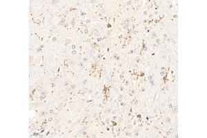 Immunohistochemistry of paraffin embedded mouse brain using P2Y12 (ABIN7075321) at dilution of 1: 1400 (400x lens) (P2RY12 anticorps)