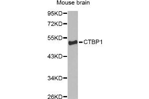 Western blot analysis of extracts of mouse brain, using CTBP1 Antibody (ABIN1872055) at 1:1000 dilution. (CTBP1 anticorps)