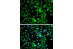 Immunofluorescence analysis of MCF-7 cells using SYCE1 antibody (ABIN5974347). (SYCE1 anticorps)