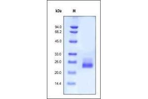 SDS-PAGE (SDS) image for Interleukin 6 (IL6) (AA 30-212) (Active) protein (ABIN2181322) (IL-6 Protein (AA 30-212))