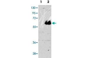 Western blot analysis of MAPT (arrow) using MAPT polyclonal antibody . (MAPT anticorps  (C-Term))