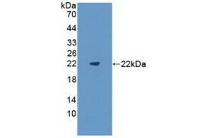WB of Protein Standard: different control antibodies against Highly purified E. (FLT3LG Kit CLIA)