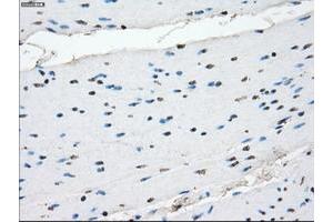 Image no. 11 for anti-Crystallin, alpha B (CRYAB) antibody (ABIN1497647)