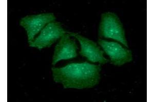 ICC/IF analysis of KCTD15 in HeLa cells. (KCTD15 anticorps  (AA 1-159))