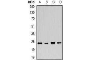 Western blot analysis of FGF14 expression in U937 (A), mouse brain (B), mouse spleen (C), rat brain (D) whole cell lysates. (FGF14 anticorps)