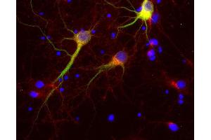 Indirect immunolabeling of PFA fixed rat hippocampus neurons with rabbit anti-Vti1a (dilution 1 : 500; red) and mouse anti-MAP 2 (cat. (VTI1A anticorps)