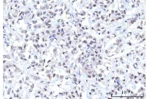 IHC analysis of RBM22 using anti-RBM22 antibody (ABIN7600268). (RBM22 anticorps  (AA 17-406))