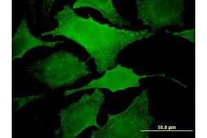 Immunofluorescence of monoclonal antibody to MAP3K13 on HeLa cell.