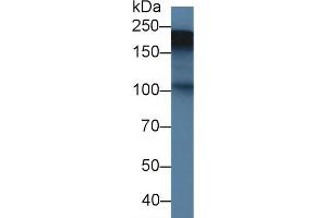 Western blot analysis of Rat Placenta lysate, using Rat TNC Antibody (1. (TNC anticorps  (AA 513-621))