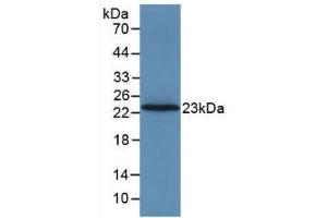 Western blot analysis of recombinant Rat F2. (Prothrombin anticorps  (AA 44-200))