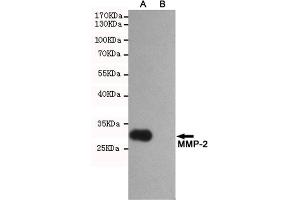 Western blot analysis of extracts from CHO-K1 (B) and CHO-K1 transfected by P-2 fragment(A) cell lysates using P-2 mouse mAb (1:2000 diluted).
