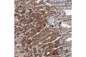 Immunohistochemical staining of human stomach with LRCH4 polyclonal antibody  shows strong cytoplasmic and membranous positivity in glandular cells. (LRCH4 anticorps)