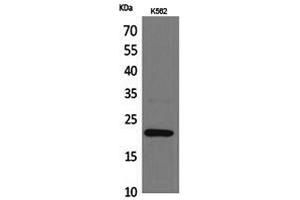 Western Blotting (WB) image for anti-Interleukin 6 (IL6) antibody (ABIN5959615) (IL-6 anticorps)