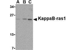Western Blotting (WB) image for anti-NFKB Inhibitor Interacting Ras-Like 1 (NKIRAS1) (C-Term) antibody (ABIN1030463)