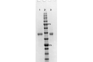 SDS-PAGE results of MEK2 Recombinant Protein.