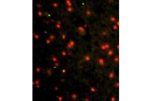 Immunofluorescence analysis of CDH4 Antibody (N-term) Antibody with paraffin-embedded human brain tissue.