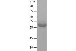Western Blotting (WB) image for Leucine-Rich alpha-2 Glycoprotein 1 (LRG1) (AA 36-347) protein (His tag) (ABIN7123753)