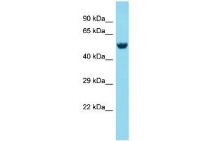 Host: Rabbit Target Name: MEX3A Sample Type: Fetal Brain lysates Antibody Dilution: 1. (MEX3A anticorps  (N-Term))