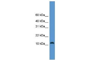 WB Suggested Anti-CDC26 Antibody Titration: 0. (CDC26 anticorps  (Middle Region))