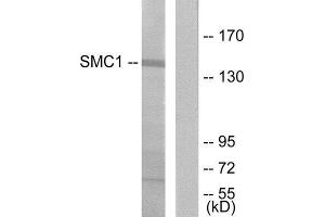 Western Blotting (WB) image for anti-Structural Maintenance of Chromosomes 1A (SMC1A) (Ser957) antibody (ABIN1848149) (SMC1A anticorps  (Ser957))