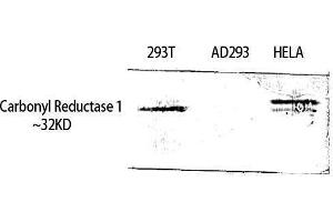 Western Blotting (WB) image for anti-Carbonyl Reductase 1 (CBR1) (Internal Region) antibody (ABIN3183645) (CBR1 anticorps  (Internal Region))
